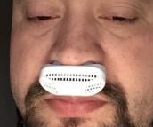 EaseSleep™ Anti snoring Micro CPAP Device photo review